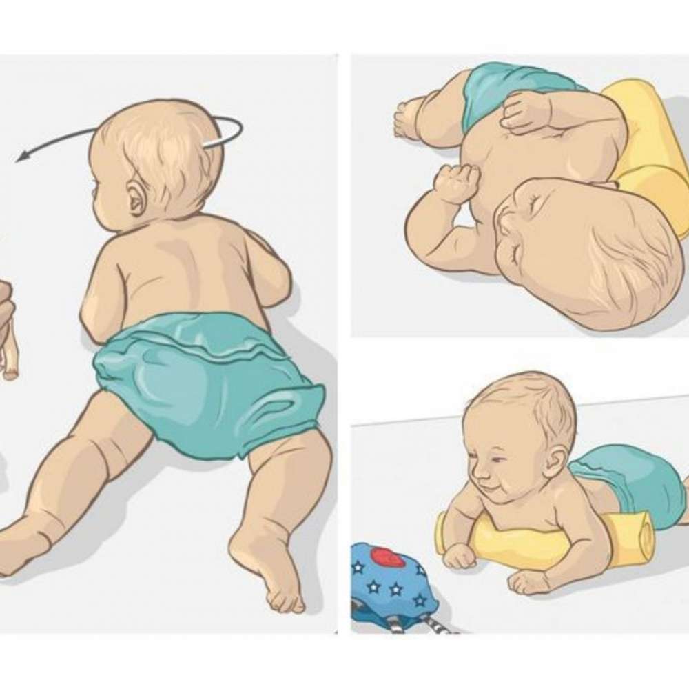 Как распознать гипертонус у новорожденных