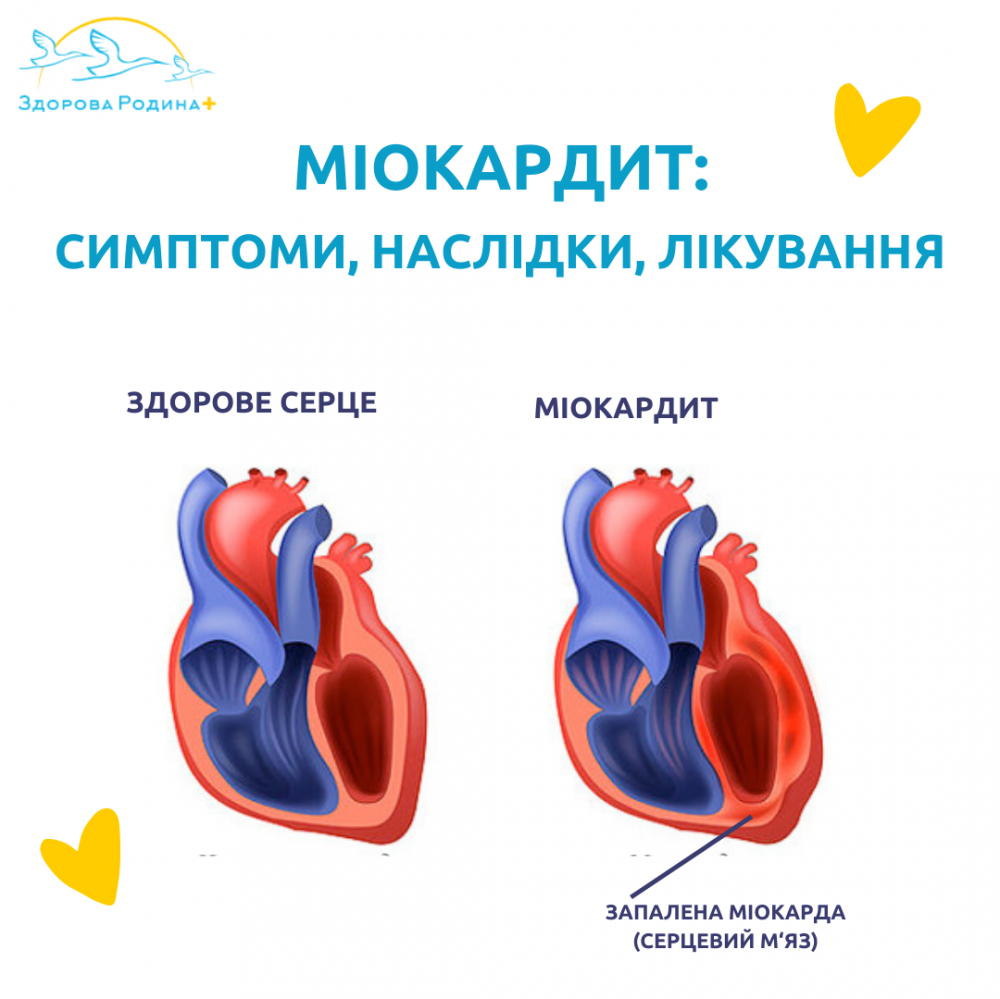 Диагностика и лечение сердечной недостаточности (Сергиев Посад)